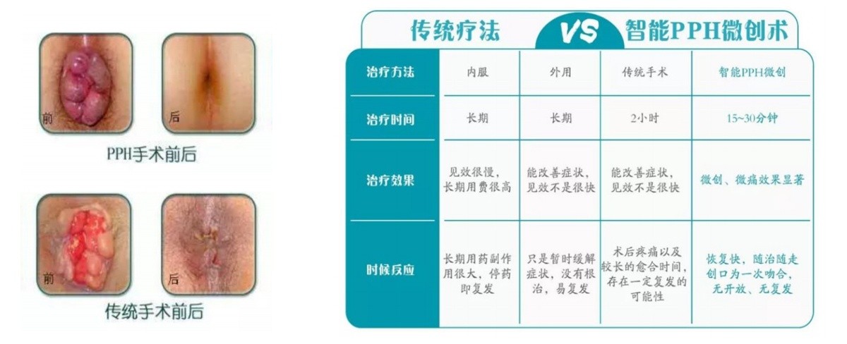 肛肠科.jpg